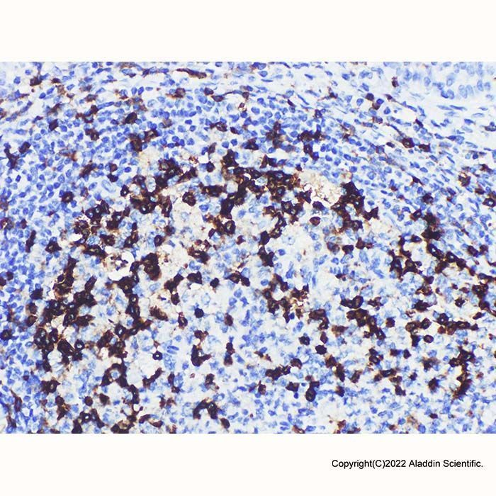 PD1 Mouse mAb -    by Aladdin Scientific