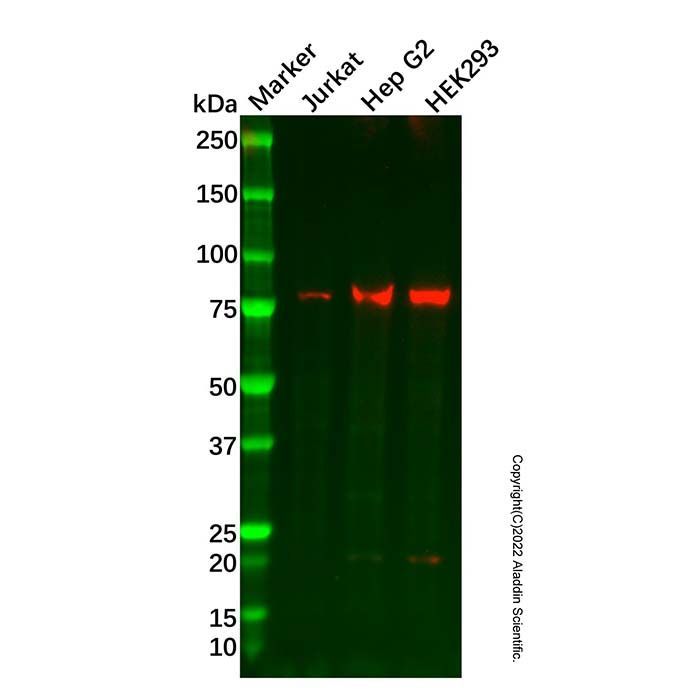 Recombinant PFKL Antibody -    by Aladdin Scientific