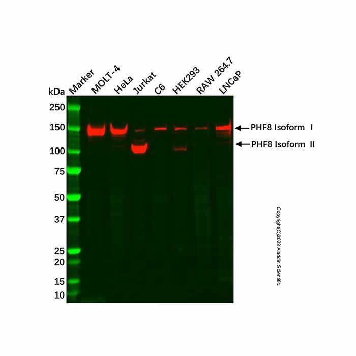 Recombinant PHF8 Antibody -    by Aladdin Scientific