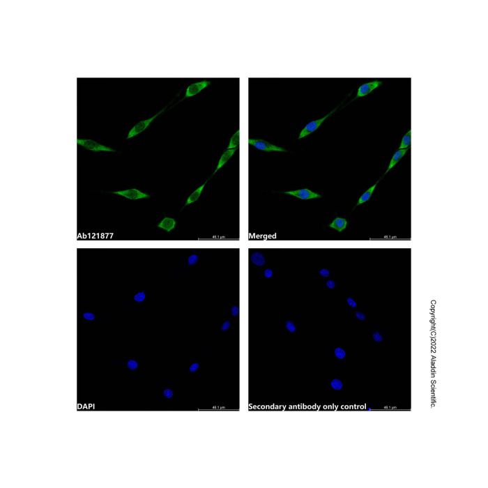 Recombinant PIM1 Antibody -    by Aladdin Scientific