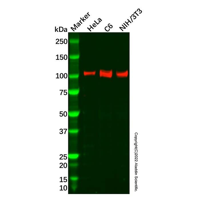 Recombinant PKC mu/PKD Antibody -    by Aladdin Scientific