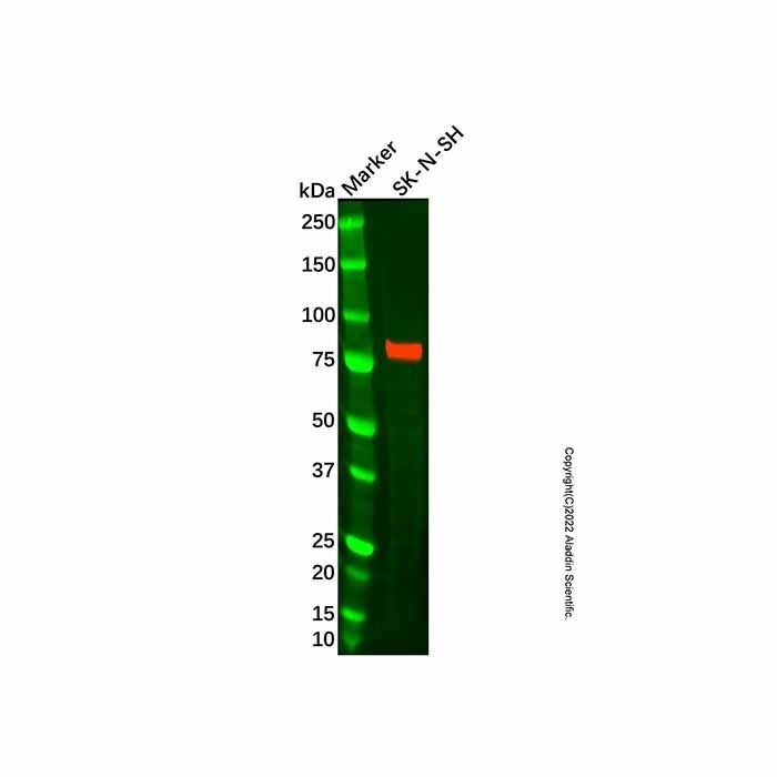 Recombinant PPM1E Antibody -    by Aladdin Scientific