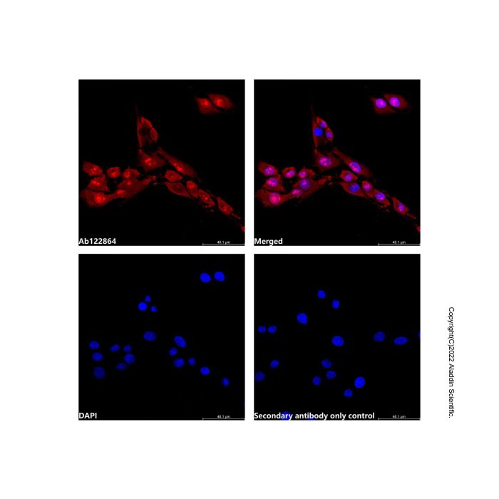 PPP2R4 Antibody -    by Aladdin Scientific