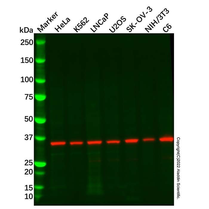 Recombinant PSMD14 Antibody -    by Aladdin Scientific