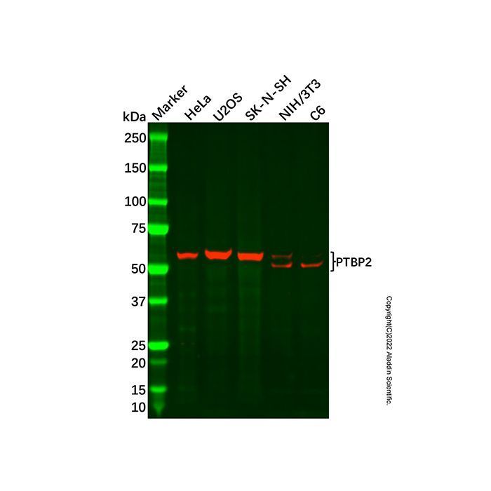 Recombinant PTBP2 Antibody -    by Aladdin Scientific