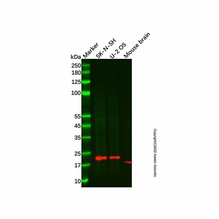 Recombinant PTN Antibody -    by Aladdin Scientific