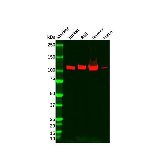 Recombinant PYK2 Antibody -    by Aladdin Scientific