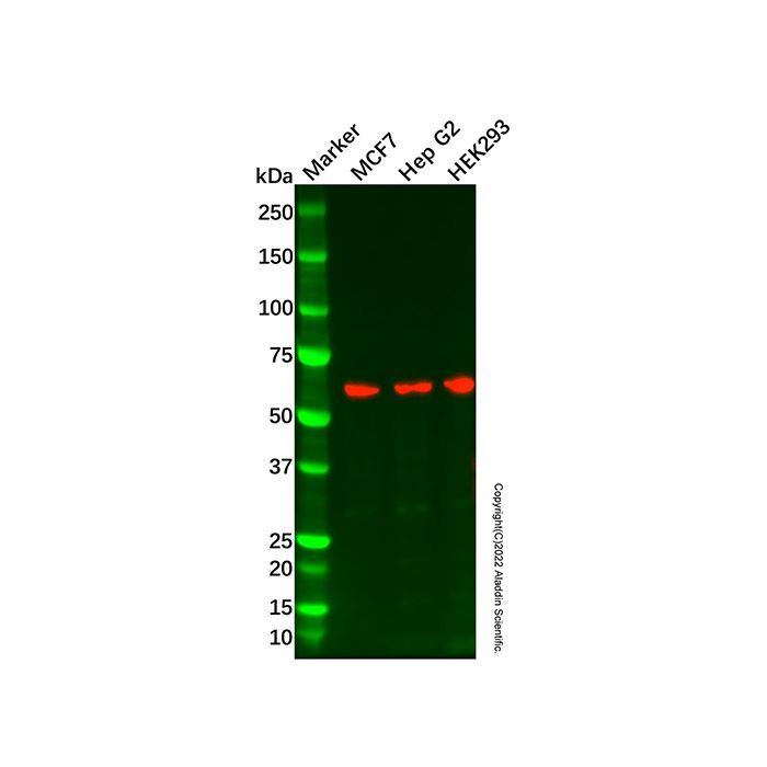 Recombinant Retinoic Acid Receptor alpha Antibody -    by Aladdin Scientific