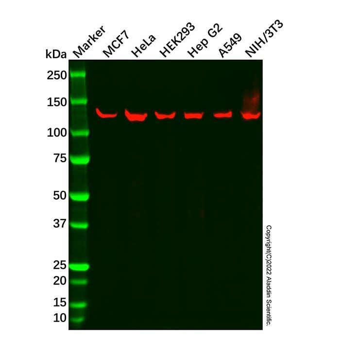 Recombinant RNF20 Antibody -    by Aladdin Scientific