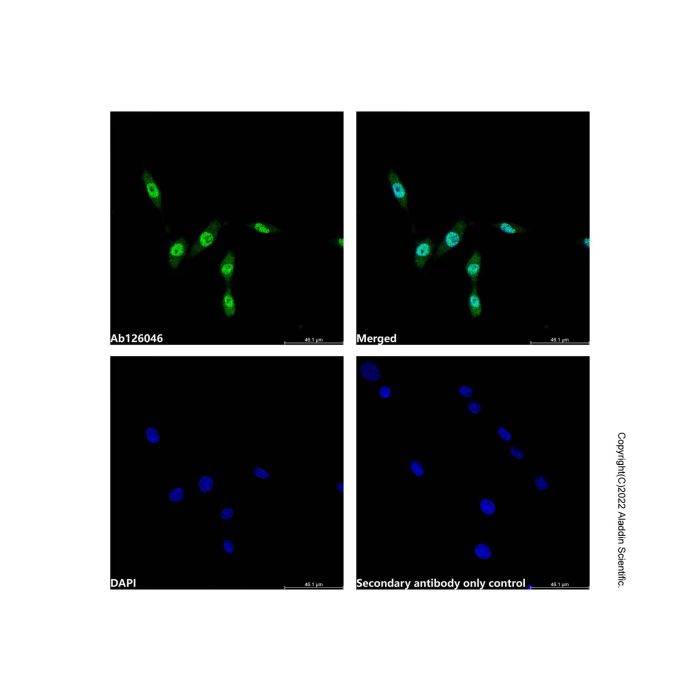 Recombinant RSK2 Antibody -    by Aladdin Scientific