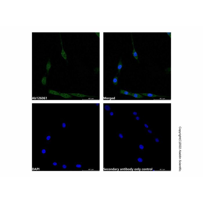 Recombinant RSK1 p90 Antibody -    by Aladdin Scientific