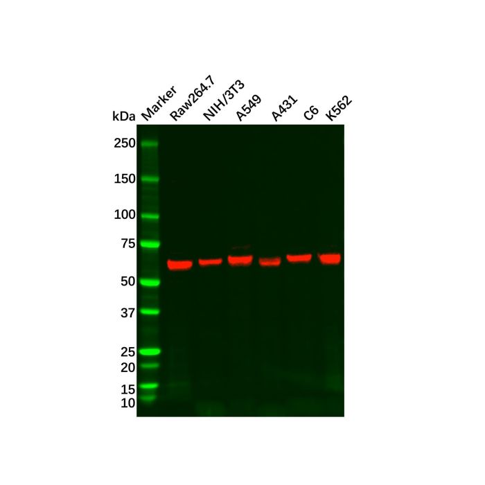 Recombinant S6K1 Antibody -    by Aladdin Scientific