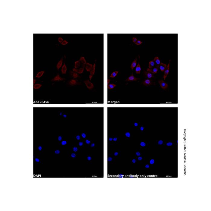 Recombinant SARA Antibody -    by Aladdin Scientific