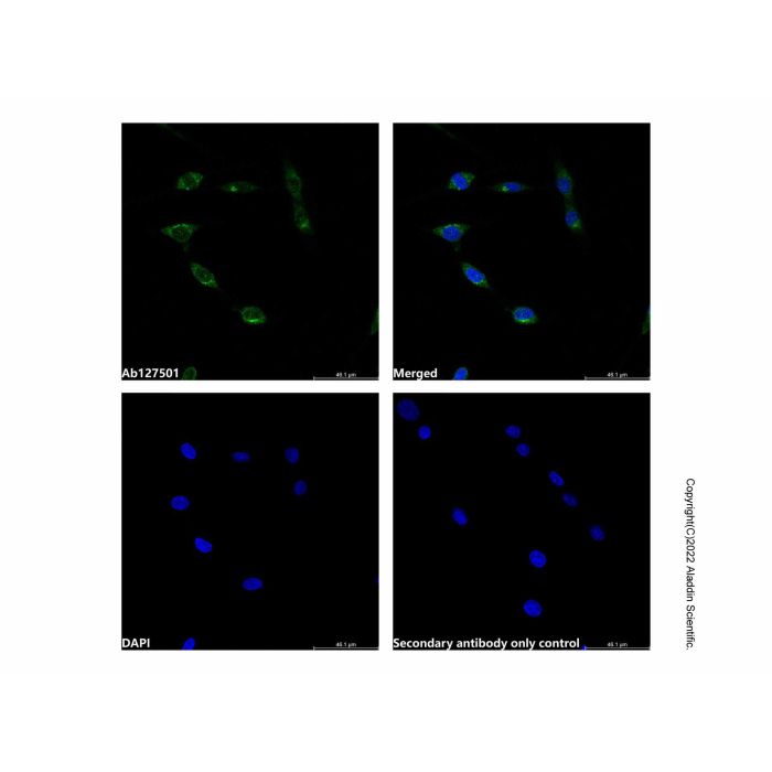 Recombinant SHP1 Antibody -    by Aladdin Scientific