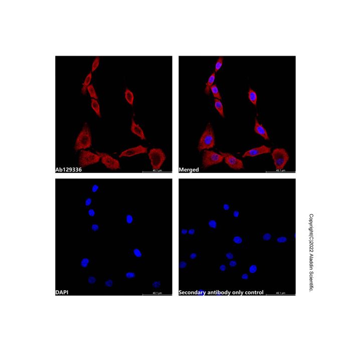 StAR Antibody -    by Aladdin Scientific