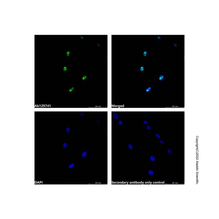 Sumo 1 Antibody -    by Aladdin Scientific