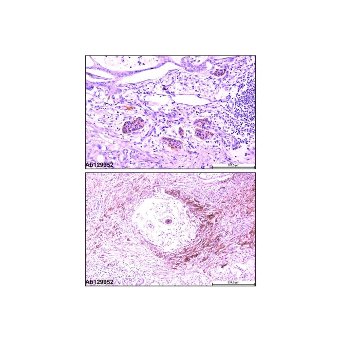 Recombinant Synaptophysin Antibody -    by Aladdin Scientific