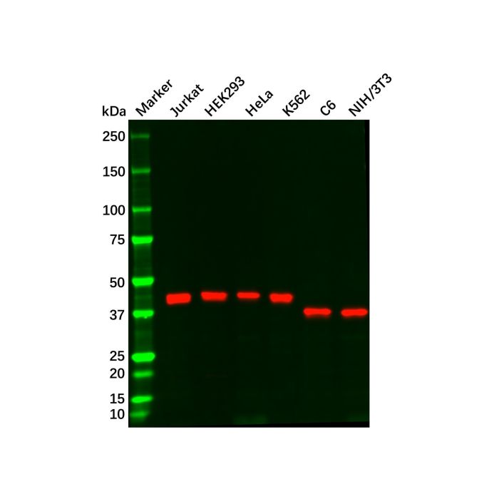 TBP Mouse mAb -    by Aladdin Scientific