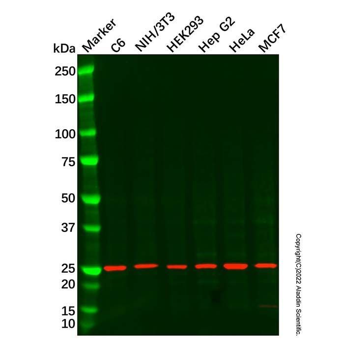 TIGAR Antibody -    by Aladdin Scientific