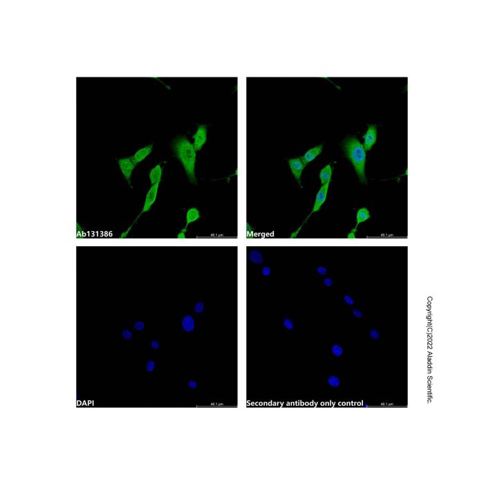 TIP49A Antibody -    by Aladdin Scientific
