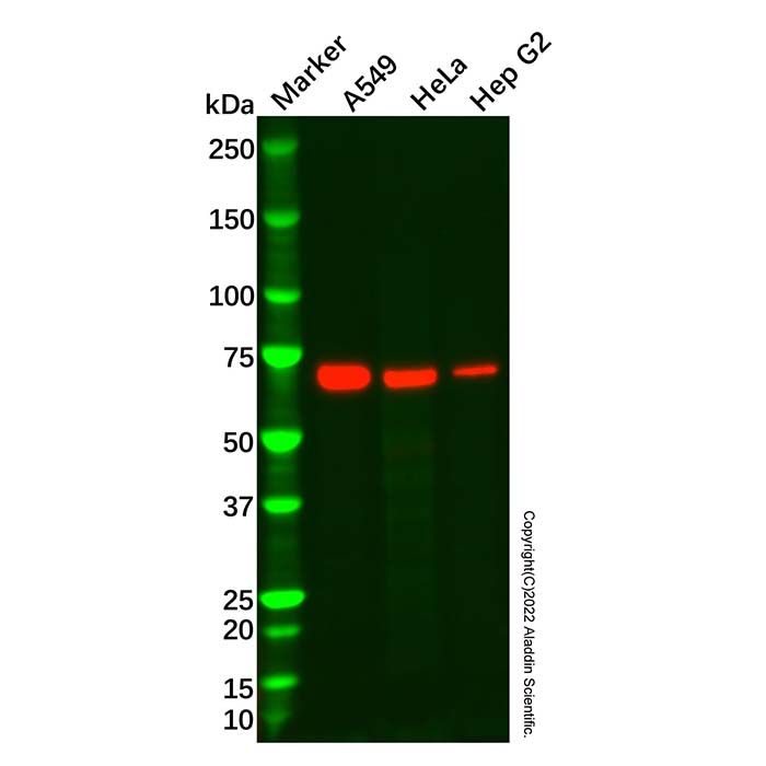 Transketolase Antibody -    by Aladdin Scientific