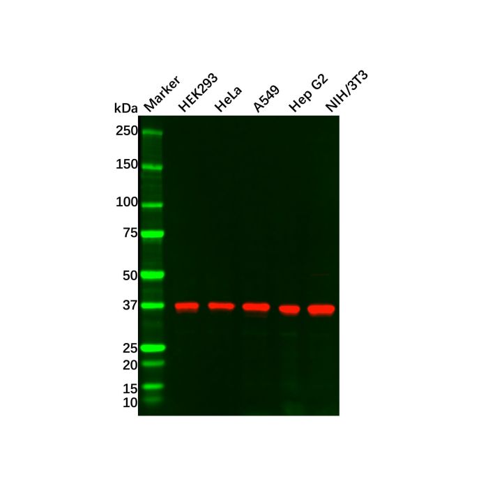 Recombinant TTF1 Antibody -    by Aladdin Scientific