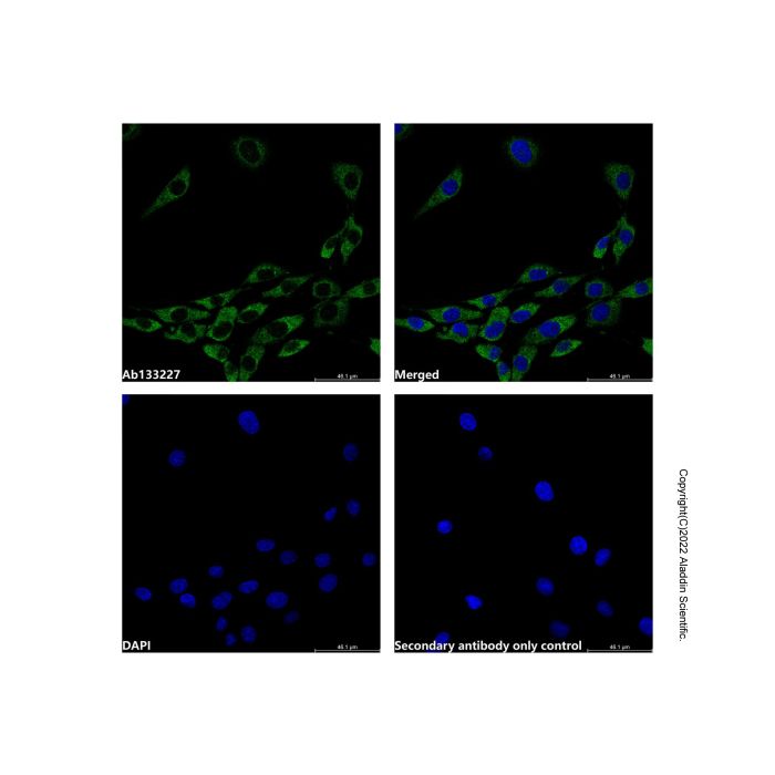 UBE2C Antibody -    by Aladdin Scientific