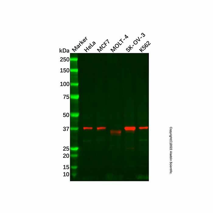 Recombinant UFD1L Antibody -    by Aladdin Scientific