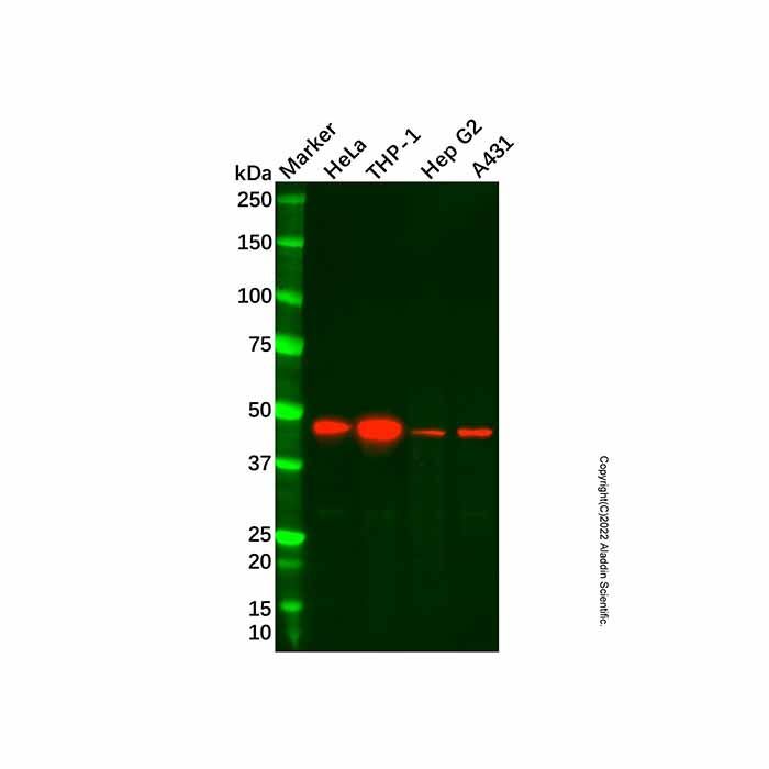 Recombinant VASP Antibody -    by Aladdin Scientific