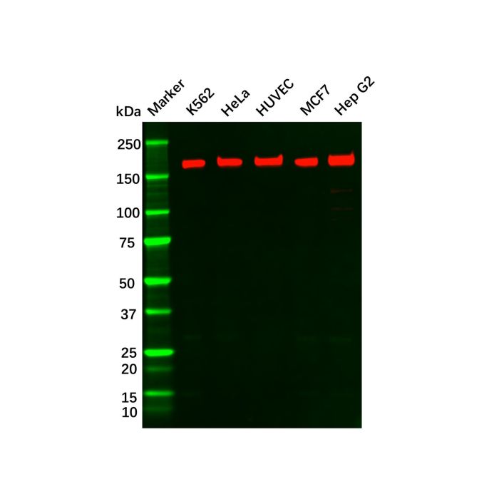 Recombinant VEGF Receptor 1 Antibody - by Aladdin Scientific