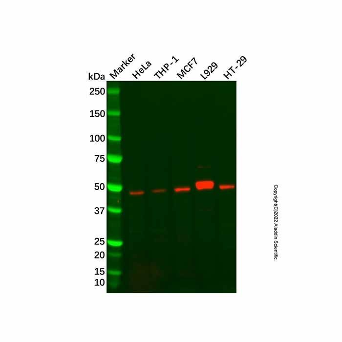Recombinant Vitamin D Receptor Antibody -    by Aladdin Scientific