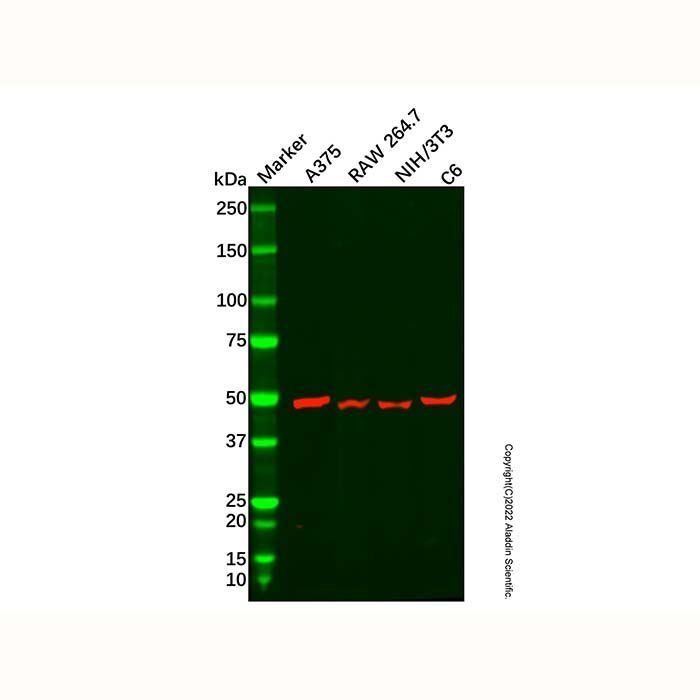 Recombinant WIPI1 Antibody -    by Aladdin Scientific