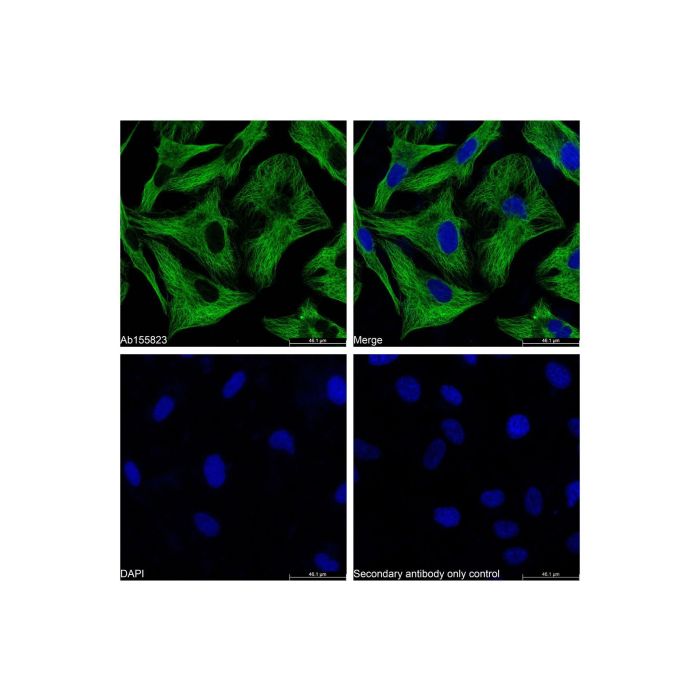 Goat Anti-Mouse IgG H&L (FITC) -    by Aladdin Scientific