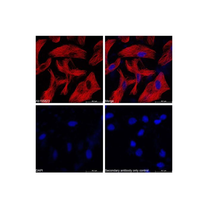 Goat Anti-Mouse IgG H&L (Cy5) -    by Aladdin Scientific
