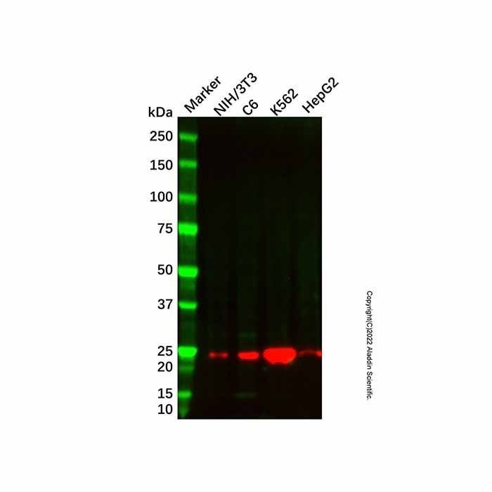 SOD2 Mouse mAb -    by Aladdin Scientific