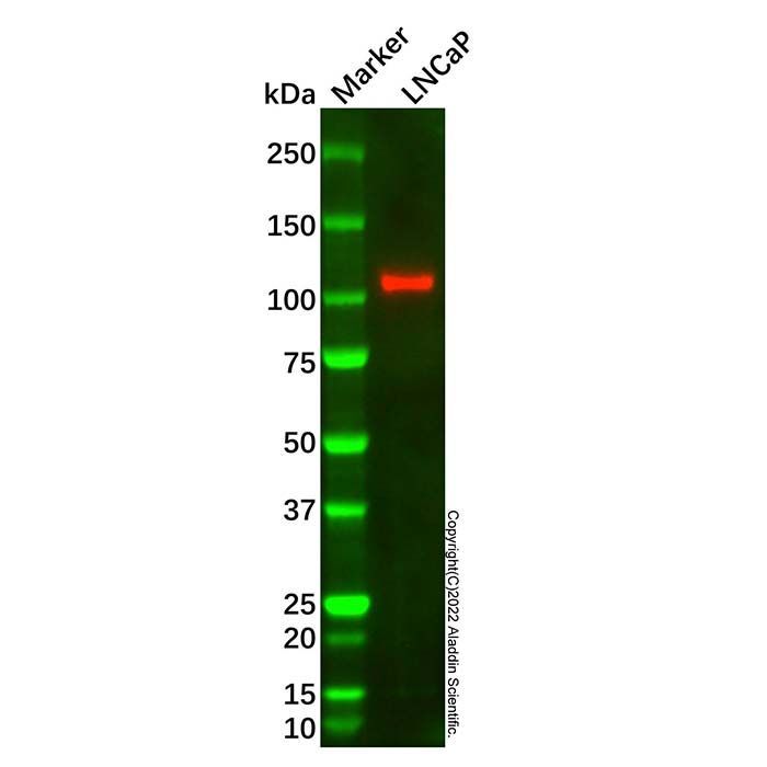 E-Cadherin Mouse mAb -    by Aladdin Scientific