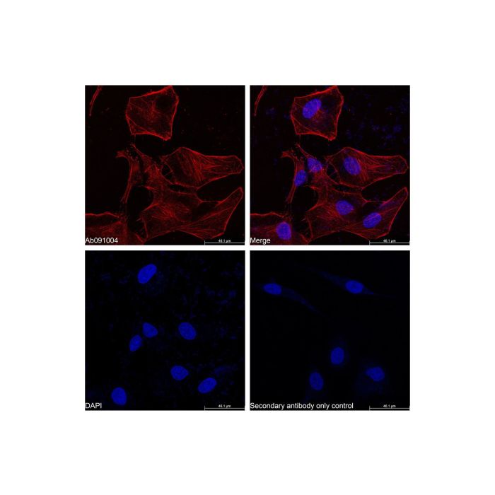 Goat Anti-Rabbit IgG H&L (Cy5) - by Aladdin Scientific