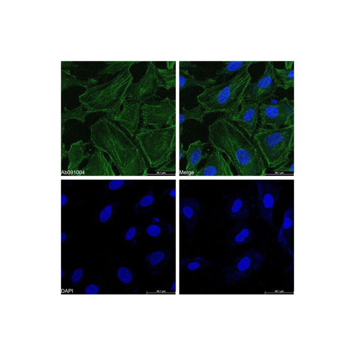 Goat Anti-Rabbit IgG H&L (FITC) - by Aladdin Scientific