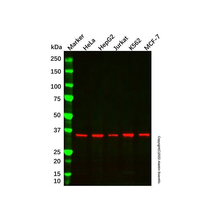 NDUFA9 Mouse mAb -    by Aladdin Scientific