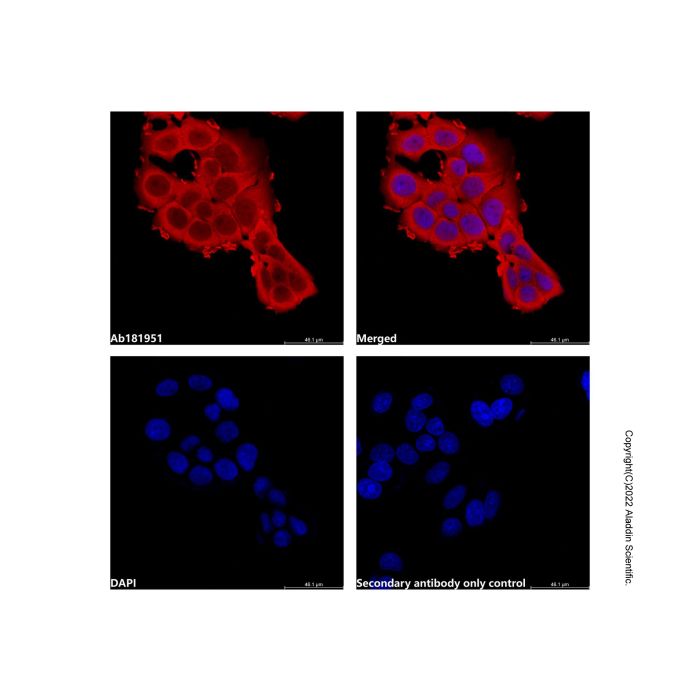 Goat Anti-Mouse IgG H&L (AF594) -    by Aladdin Scientific