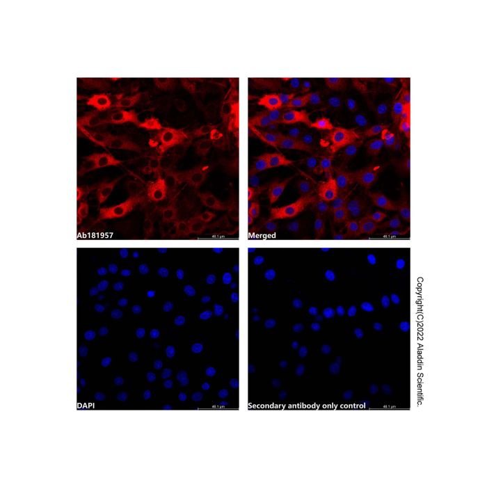 Goat Anti-Rabbit IgG H&L (AF594) -    by Aladdin Scientific