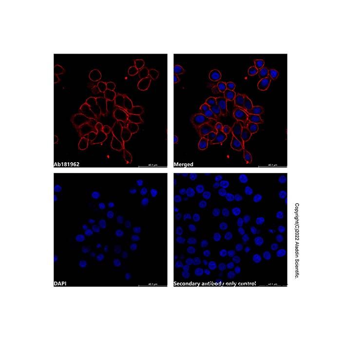 Goat Anti-Human IgG (AF594) -    by Aladdin Scientific