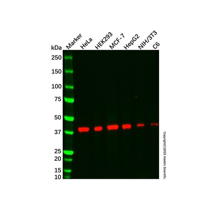 Aurora B Mouse mAb -    by Aladdin Scientific