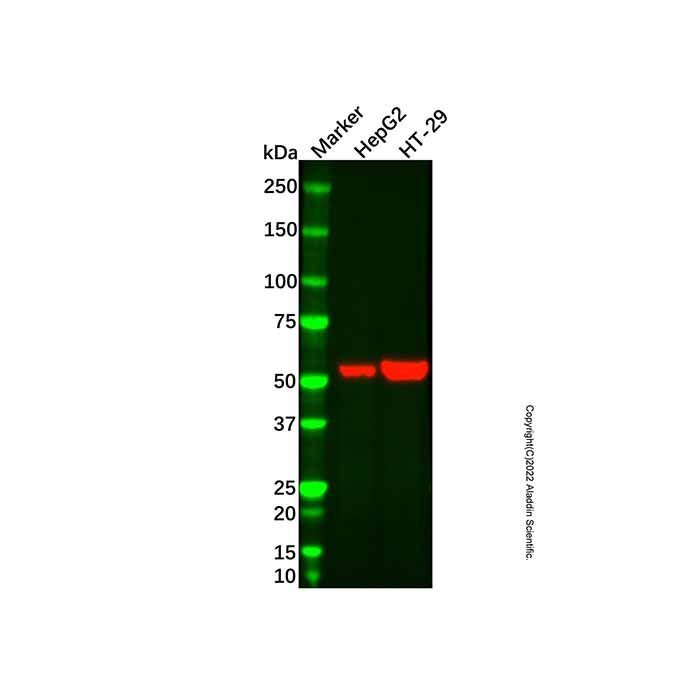 ALDH1A1 Mouse mAb -    by Aladdin Scientific