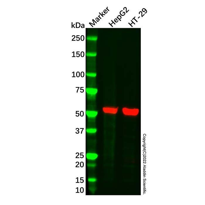 ALDH1A1 Mouse mAb -    by Aladdin Scientific