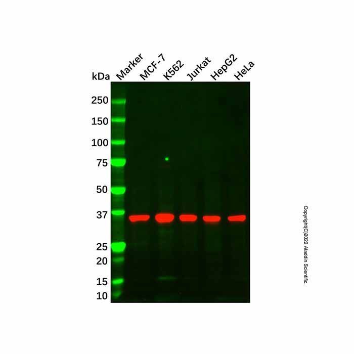 NDUFA9 Mouse mAb - by Aladdin Scientific