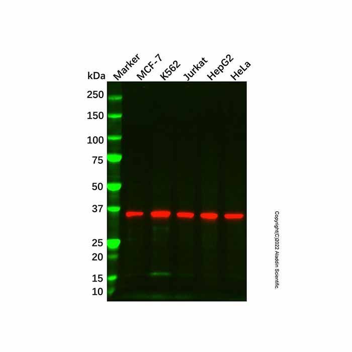 NDUFA9 Mouse mAb -    by Aladdin Scientific