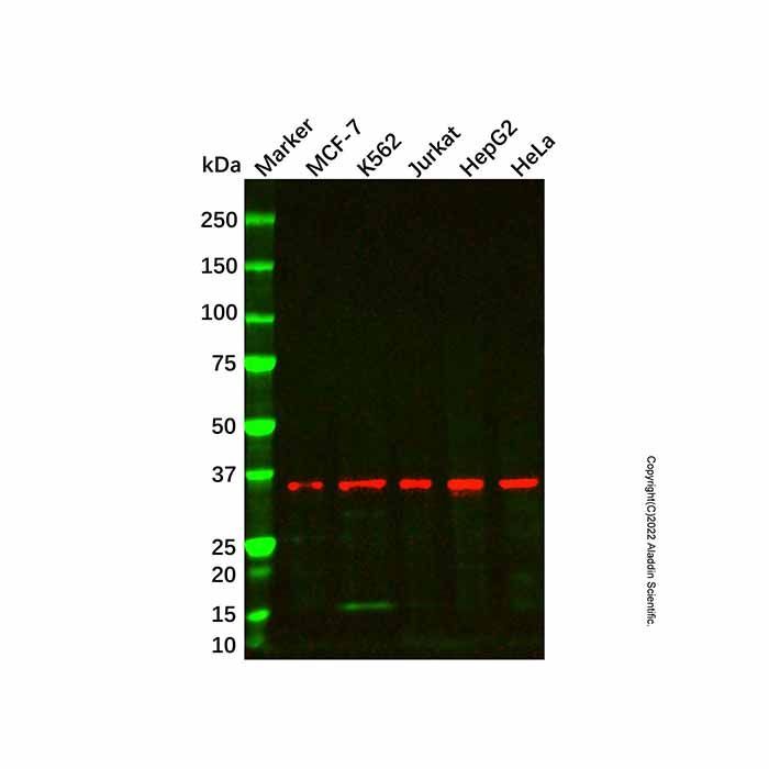 NDUFA9 Mouse mAb -    by Aladdin Scientific
