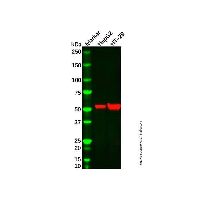 ALDH1A1 Mouse mAb -    by Aladdin Scientific