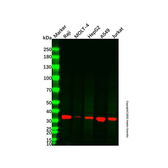 TIM 3 Mouse mAb -    by Aladdin Scientific